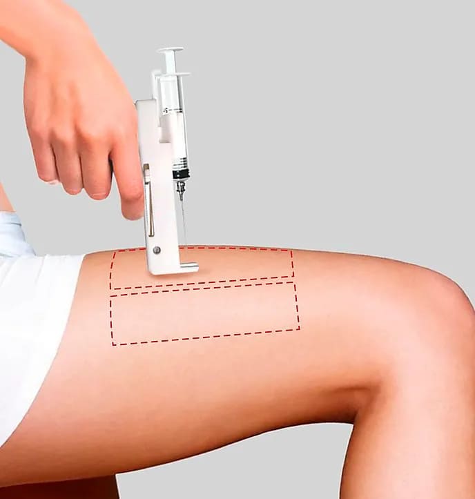Painless Syringe Injector – Bild 4