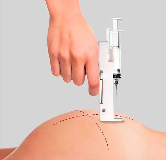Painless Syringe Injector – Bild 6